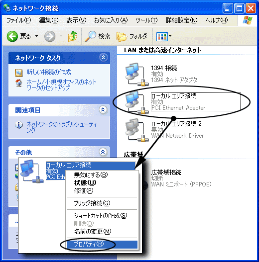 パソコン1台だけの接続でtcp Ipの設定をしたい Windows Xp サポート